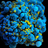 HIV-infected T cell, NIAID